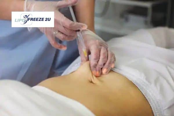 Fat Dissolving Injections Newport & Weight loss medication