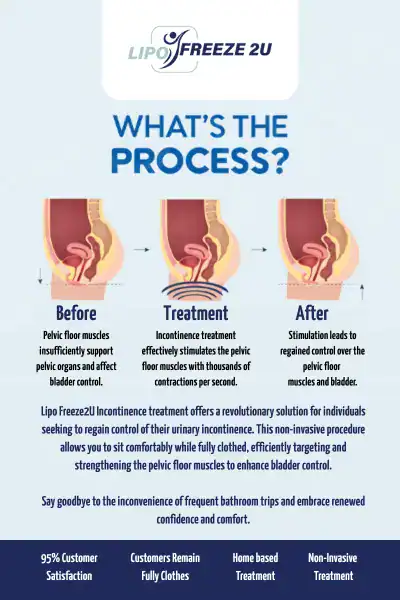 Diagram of how incontinence treatment Newport works.