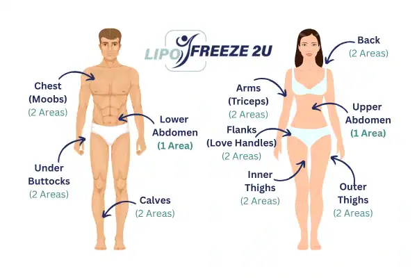 Areas you can have fat freezing treatment Newport