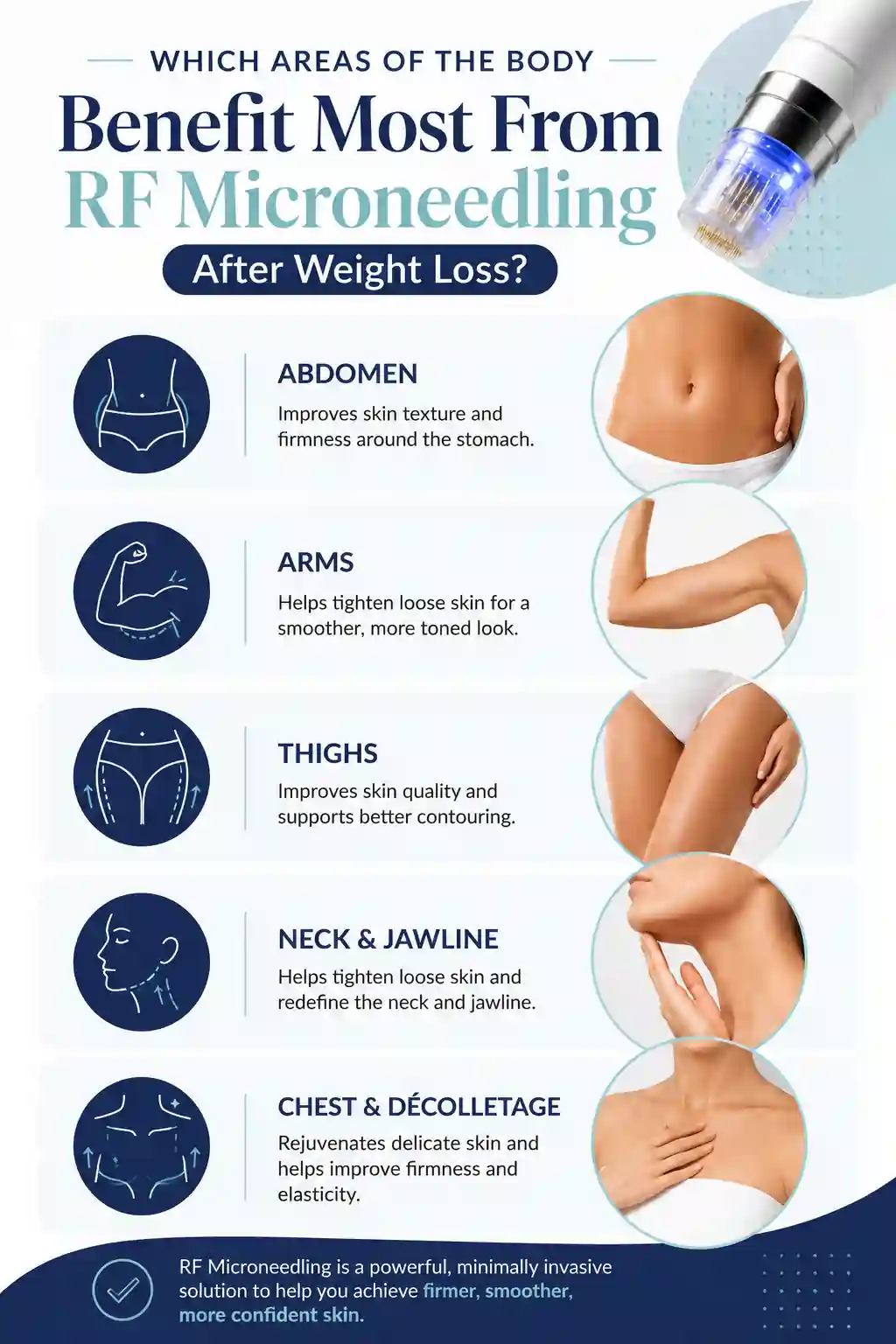 Which Areas of the Body Benefit Most From RF Microneedling After Weight Loss Newport